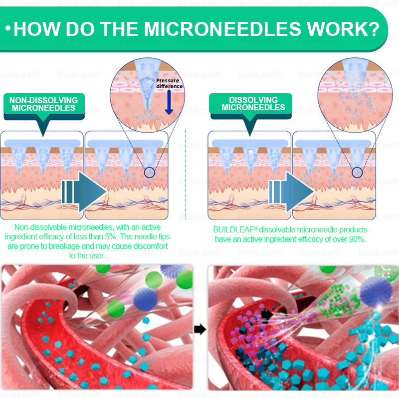 🏥Official Store | BuildLeaf® GLP-1 Nano-Microneedle Patch with Collagen & Matrixyl 3000 丨Obesity,Cardiovascular Diseas, Diabetes, Sleep Apnea, Joint Problems and More