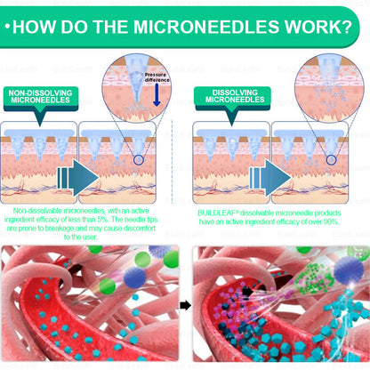🏥Official Store | BuildLeaf® GLP-1 Nano-Microneedle Patch with Collagen & Matrixyl 3000 丨Obesity,Cardiovascular Diseas, Diabetes, Sleep Apnea, Joint Problems and More
